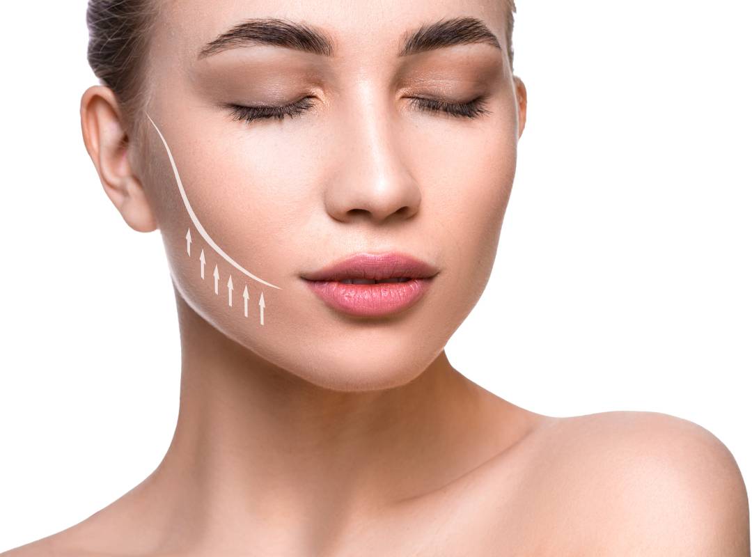 facelift treatment